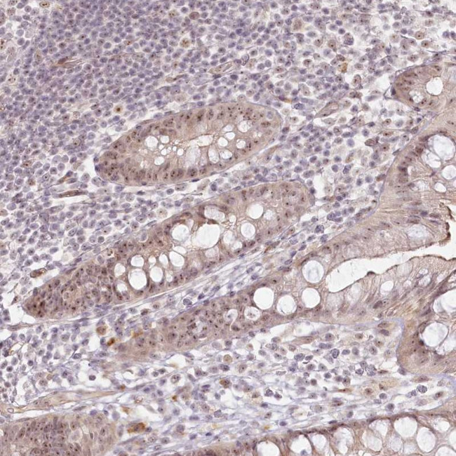 EXOSC7 Antibody in Immunohistochemistry (Paraffin) (IHC (P))