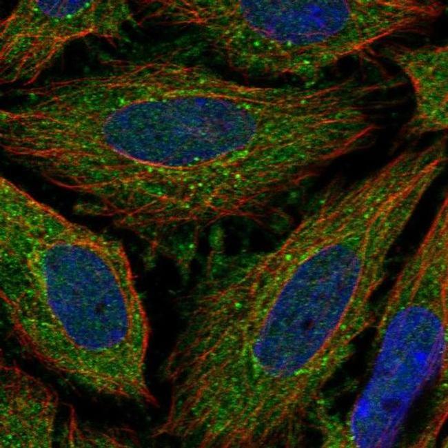 ELOVL3 Antibody in Immunocytochemistry (ICC/IF)