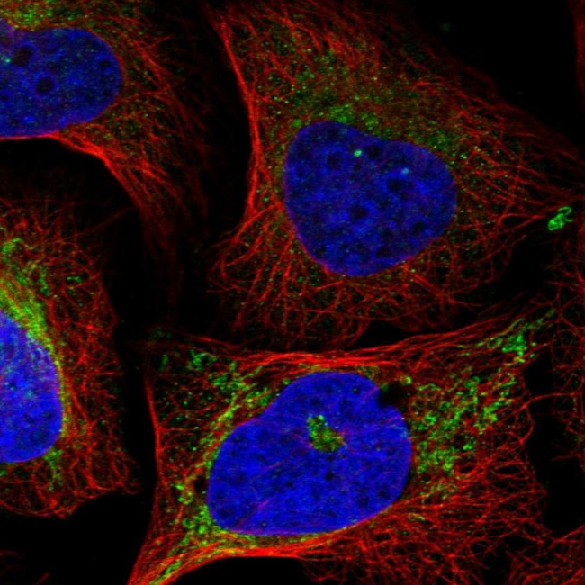 EIF2A Antibody in Immunocytochemistry (ICC/IF)