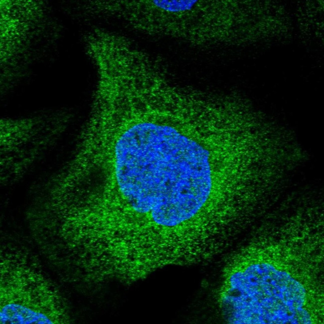 UBXD2 Antibody in Immunocytochemistry (ICC/IF)