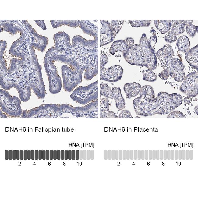 DNAH6 Antibody in Immunohistochemistry (IHC)