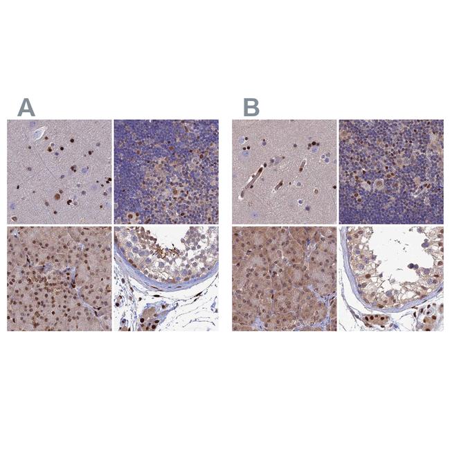 DNPEP Antibody in Immunohistochemistry (IHC)