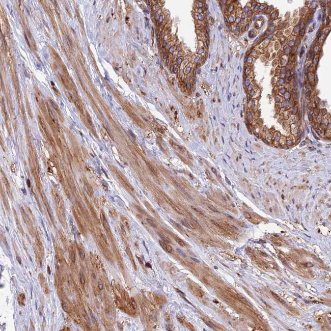 WDR1 Antibody in Immunohistochemistry (Paraffin) (IHC (P))