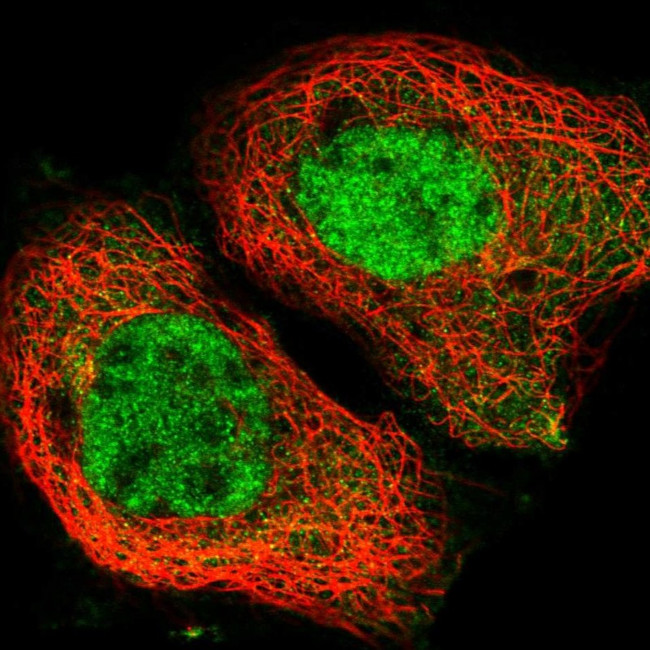 YTHDC1 Antibody in Immunocytochemistry (ICC/IF)