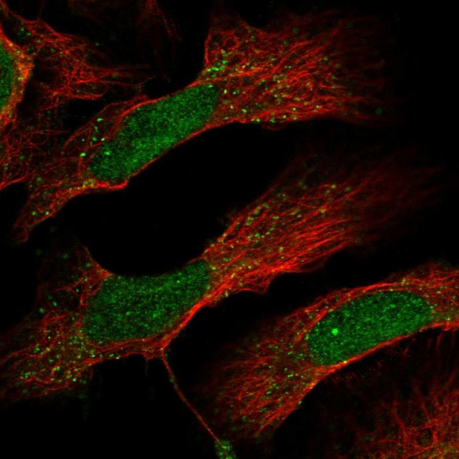 DCUN1D4 Antibody in Immunocytochemistry (ICC/IF)