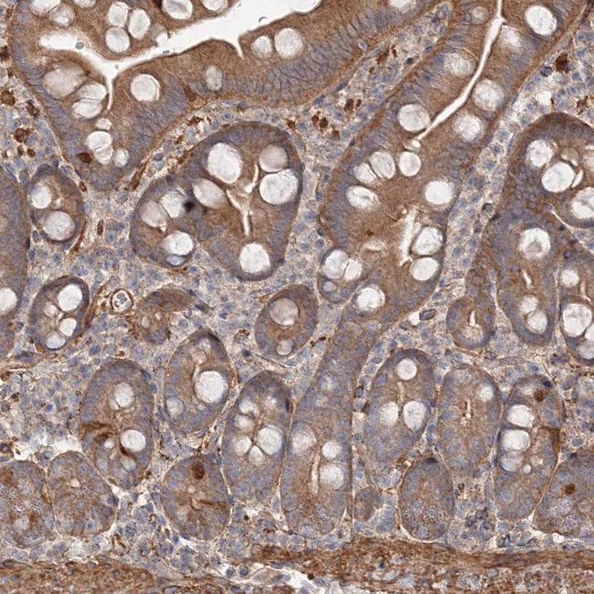 DHRS9 Antibody in Immunohistochemistry (Paraffin) (IHC (P))