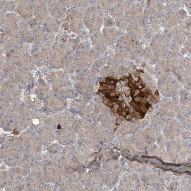 ARHGEF38 Antibody in Immunohistochemistry (Paraffin) (IHC (P))