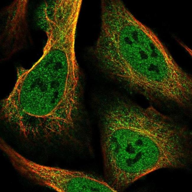 ZIP10 Antibody in Immunocytochemistry (ICC/IF)