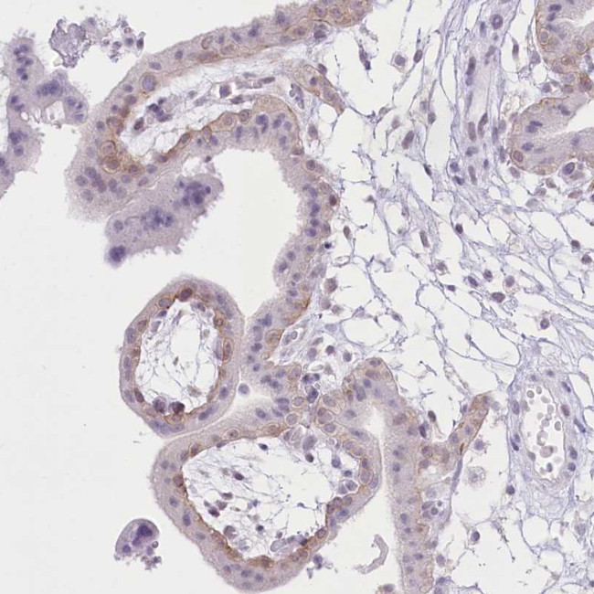 ZIP10 Antibody in Immunohistochemistry (Paraffin) (IHC (P))