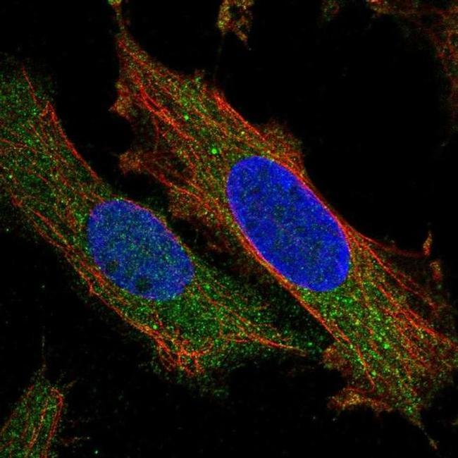 ZNF622 Antibody in Immunocytochemistry (ICC/IF)