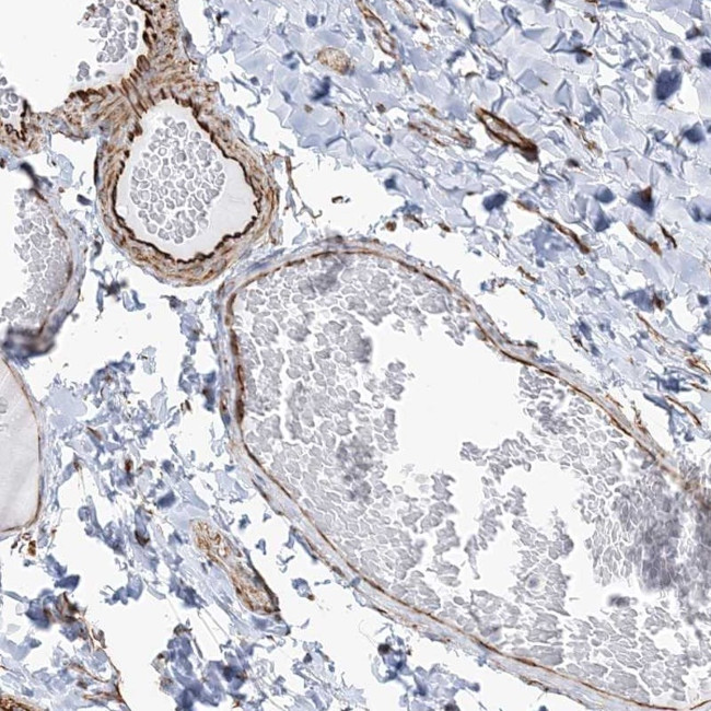 SCLT1 Antibody in Immunohistochemistry (Paraffin) (IHC (P))