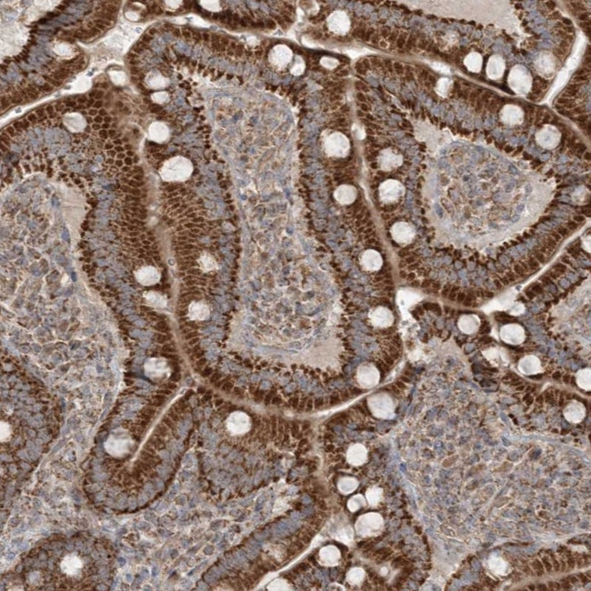 SCLT1 Antibody in Immunohistochemistry (Paraffin) (IHC (P))