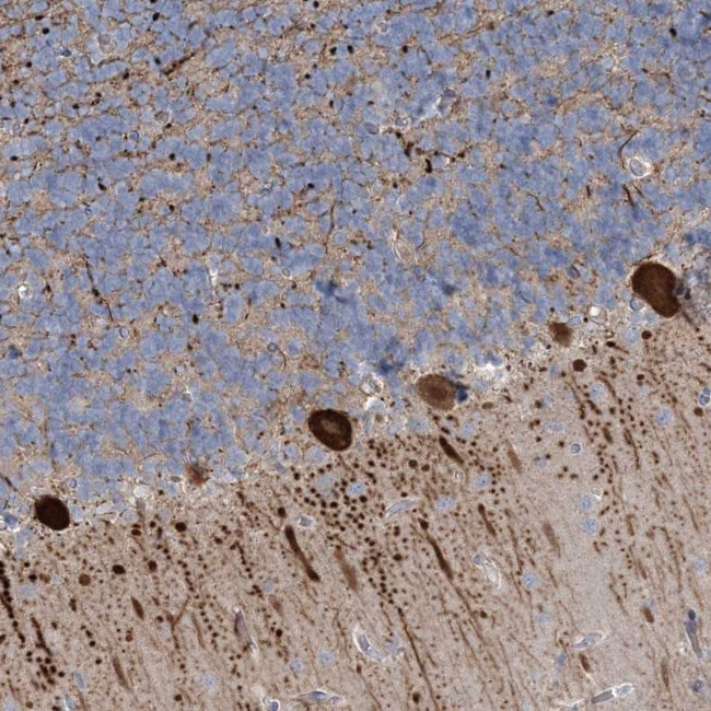 CMBL Antibody in Immunohistochemistry (Paraffin) (IHC (P))