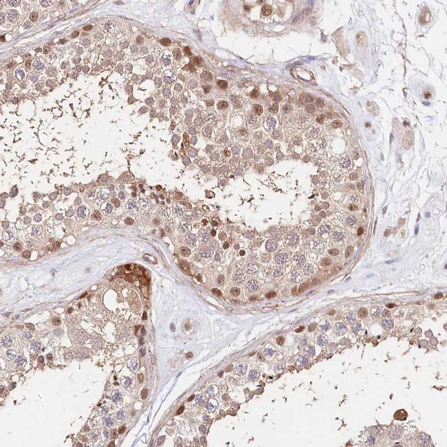 PPP2R5B Antibody in Immunohistochemistry (IHC)