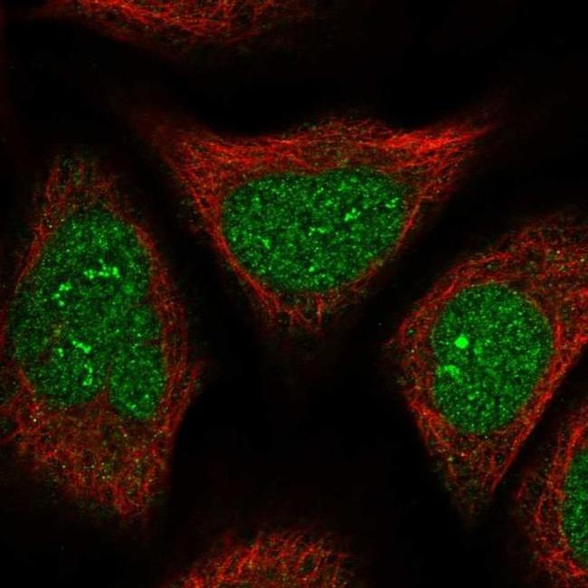 FAM76B Antibody in Immunocytochemistry (ICC/IF)