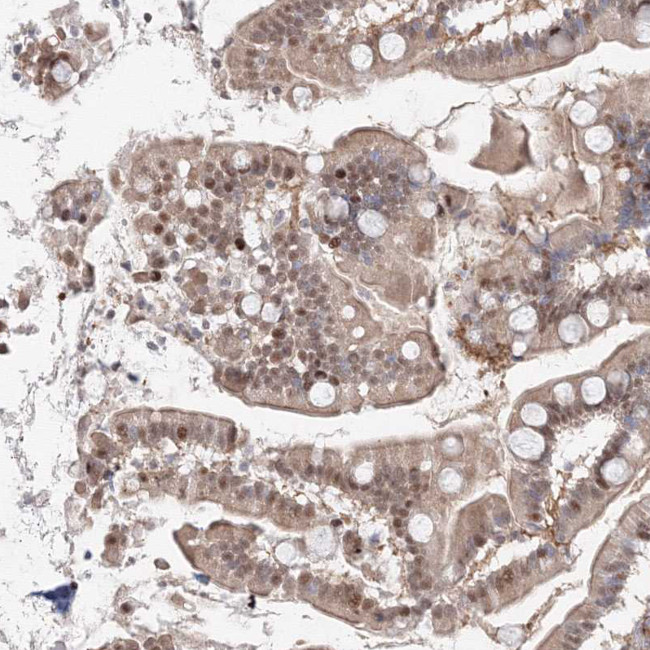 ARHGAP21 Antibody in Immunohistochemistry (Paraffin) (IHC (P))