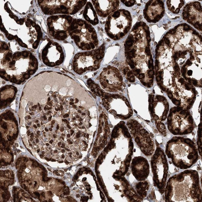 BCKDHA Antibody in Immunohistochemistry (Paraffin) (IHC (P))