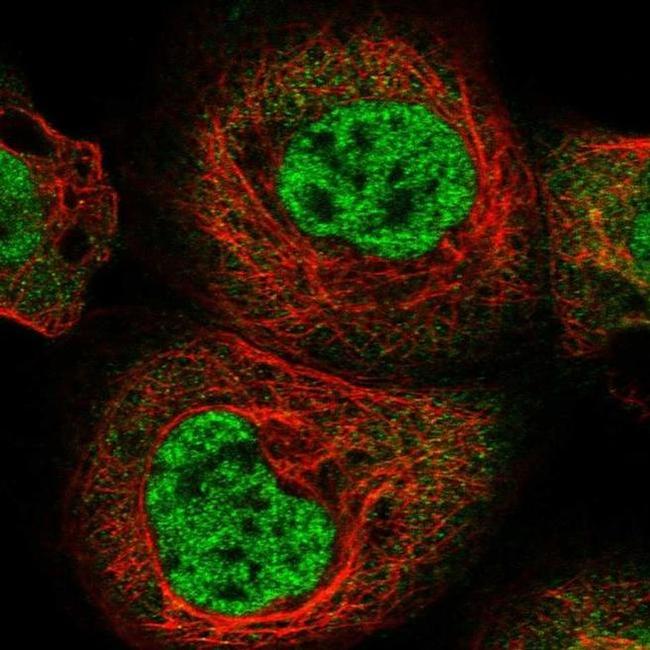 RBM15B Antibody in Immunocytochemistry (ICC/IF)