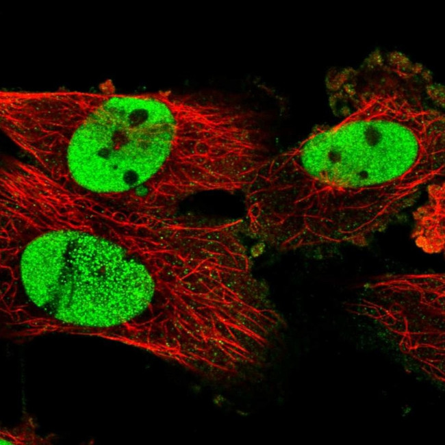 PDS5A Antibody in Immunocytochemistry (ICC/IF)