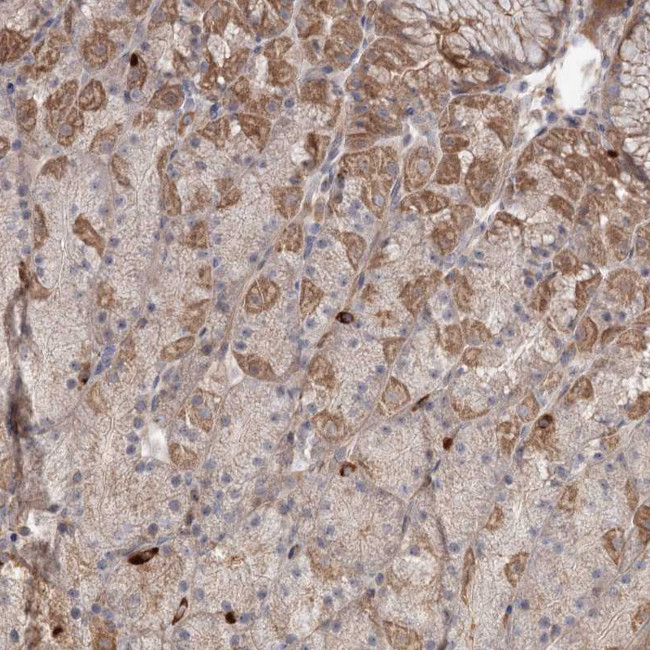 DHRS9 Antibody in Immunohistochemistry (Paraffin) (IHC (P))