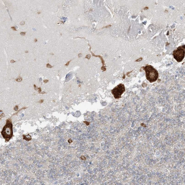 FARSB Antibody in Immunohistochemistry (Paraffin) (IHC (P))