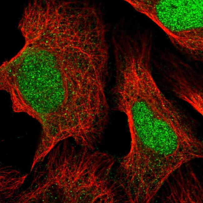 FARSB Antibody in Immunocytochemistry (ICC/IF)