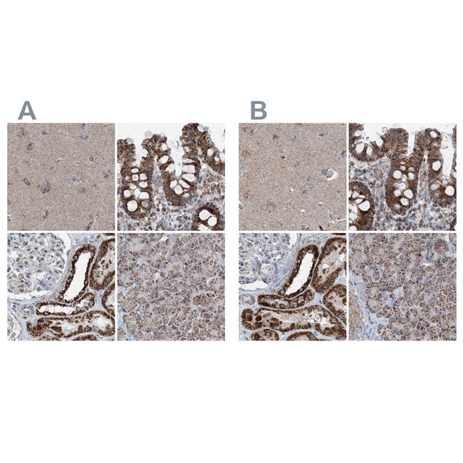 SUCLG1 Antibody in Immunohistochemistry (IHC)