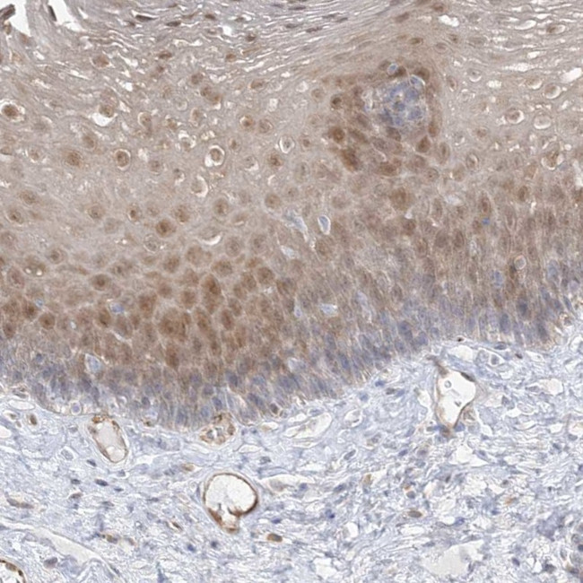 INPP1 Antibody in Immunohistochemistry (Paraffin) (IHC (P))