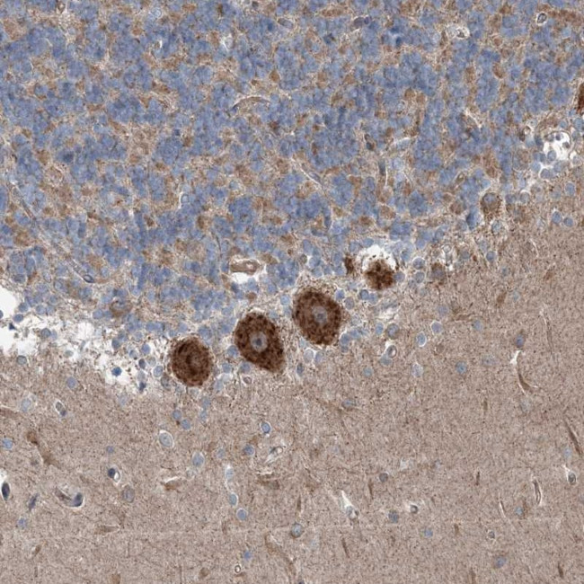 INTU Antibody in Immunohistochemistry (Paraffin) (IHC (P))