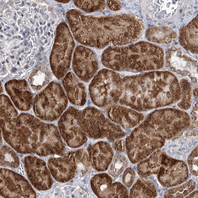 PTGR1 Antibody in Immunohistochemistry (Paraffin) (IHC (P))