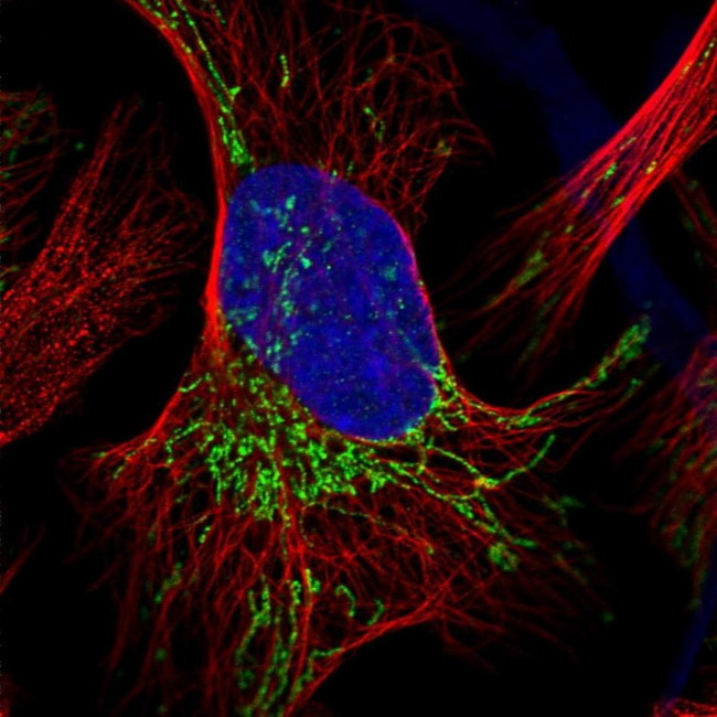 PDHB Antibody in Immunocytochemistry (ICC/IF)