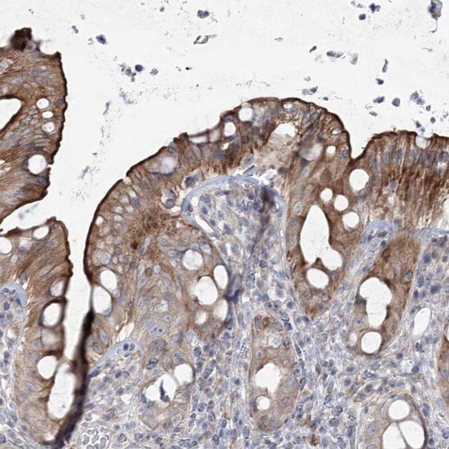 SCN11A Antibody in Immunohistochemistry (IHC)