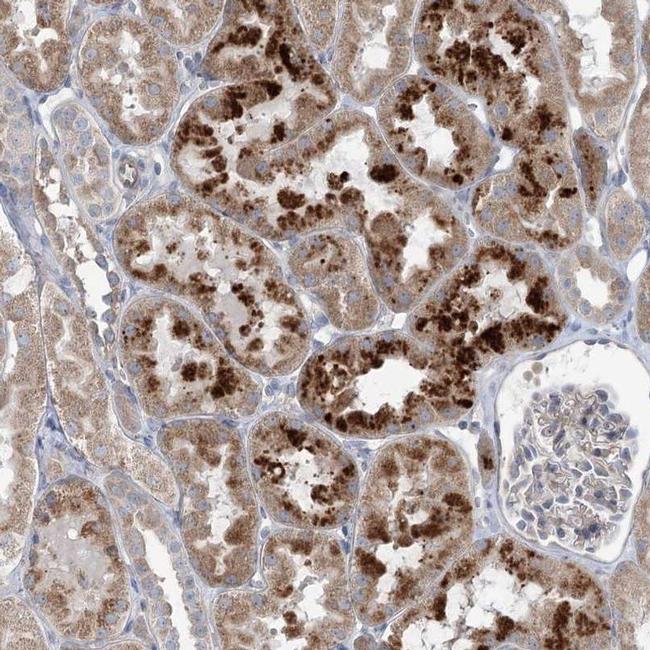 SCN11A Antibody in Immunohistochemistry (IHC)