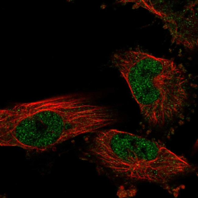 Nkx6.1 Antibody in Immunocytochemistry (ICC/IF)