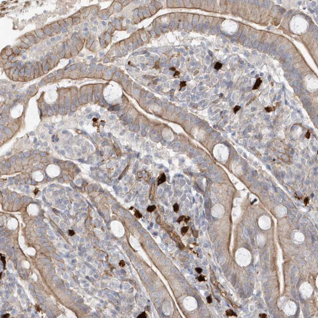 DNAH1 Antibody in Immunohistochemistry (Paraffin) (IHC (P))