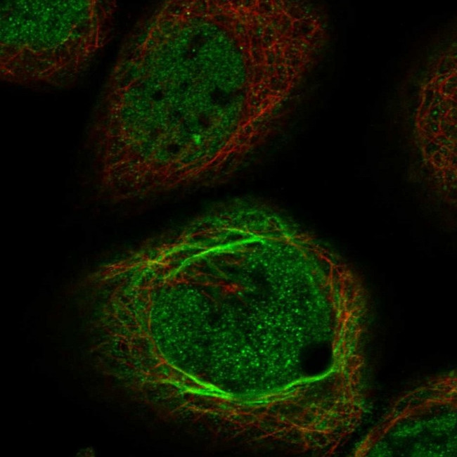 QTRTD1 Antibody in Immunocytochemistry (ICC/IF)