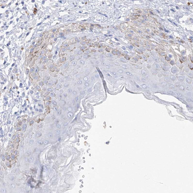 C3orf31 Antibody in Immunohistochemistry (Paraffin) (IHC (P))