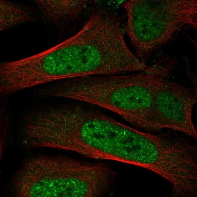 TRIP12 Antibody in Immunocytochemistry (ICC/IF)