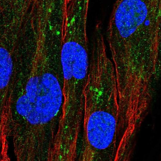 GPAT2 Antibody in Immunocytochemistry (ICC/IF)