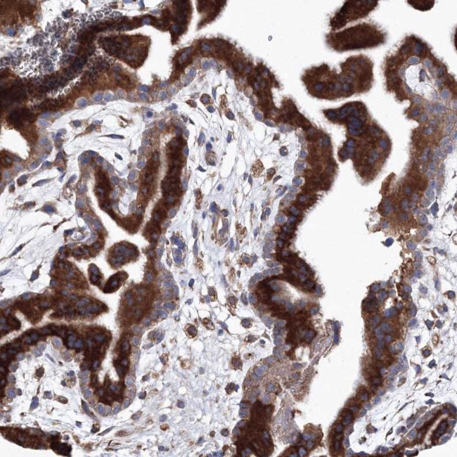 VPS8 Antibody in Immunohistochemistry (Paraffin) (IHC (P))