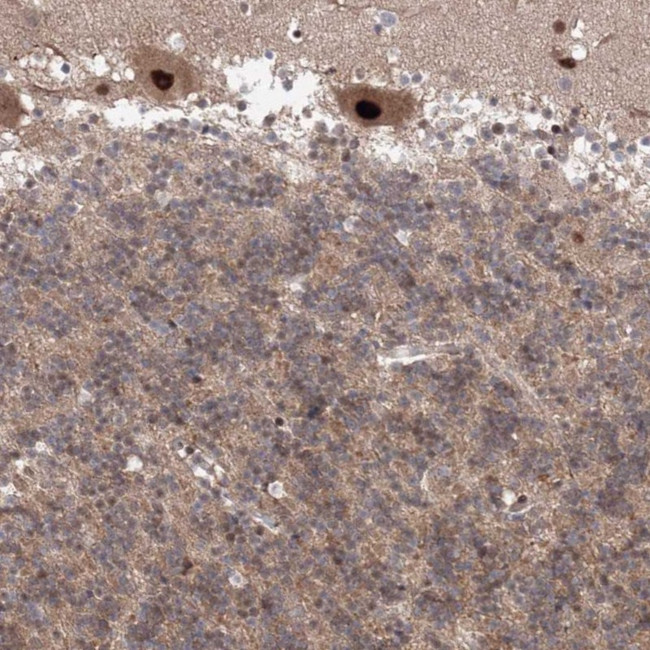 COPS4 Antibody in Immunohistochemistry (Paraffin) (IHC (P))