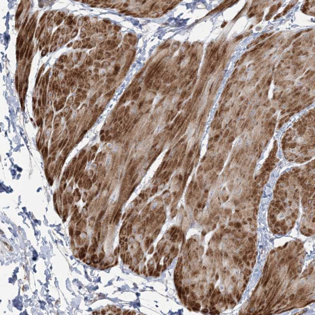 NUDT9 Antibody in Immunohistochemistry (Paraffin) (IHC (P))