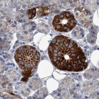 PCCB Antibody in Immunohistochemistry (Paraffin) (IHC (P))