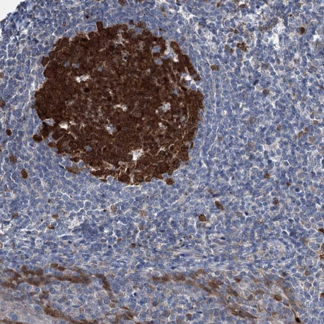 NCAPD2 Antibody in Immunohistochemistry (Paraffin) (IHC (P))