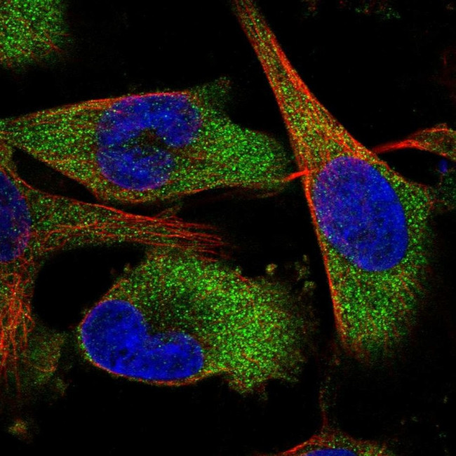 QARS Antibody in Immunocytochemistry (ICC/IF)