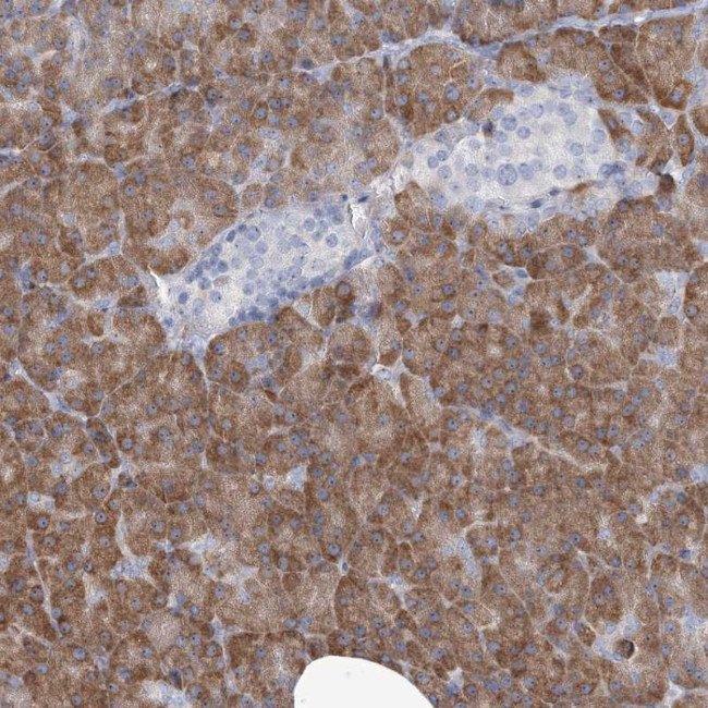 MAN2B2 Antibody in Immunohistochemistry (Paraffin) (IHC (P))