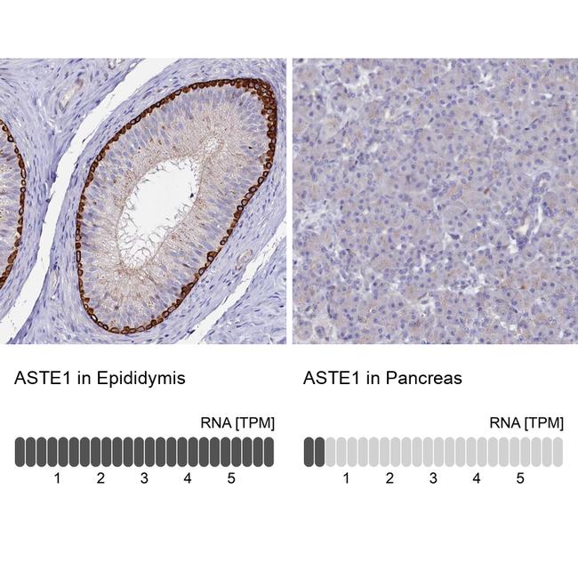 ASTE1 Antibody in Immunohistochemistry (IHC)