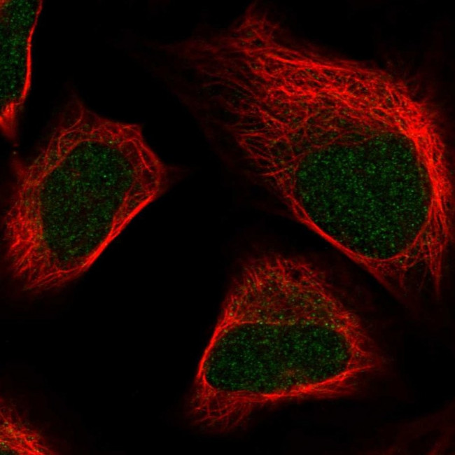 SKIV2L2 Antibody in Immunocytochemistry (ICC/IF)