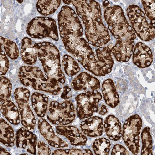 AGXT2 Antibody in Immunohistochemistry (Paraffin) (IHC (P))