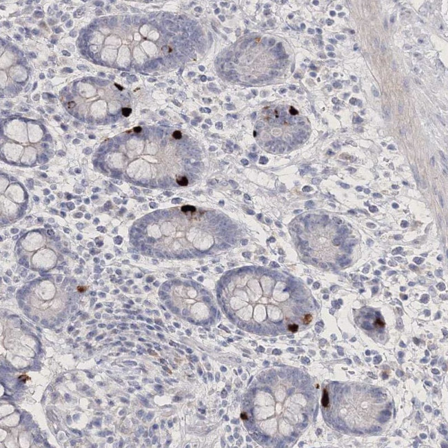 NEU4 Antibody in Immunohistochemistry (Paraffin) (IHC (P))